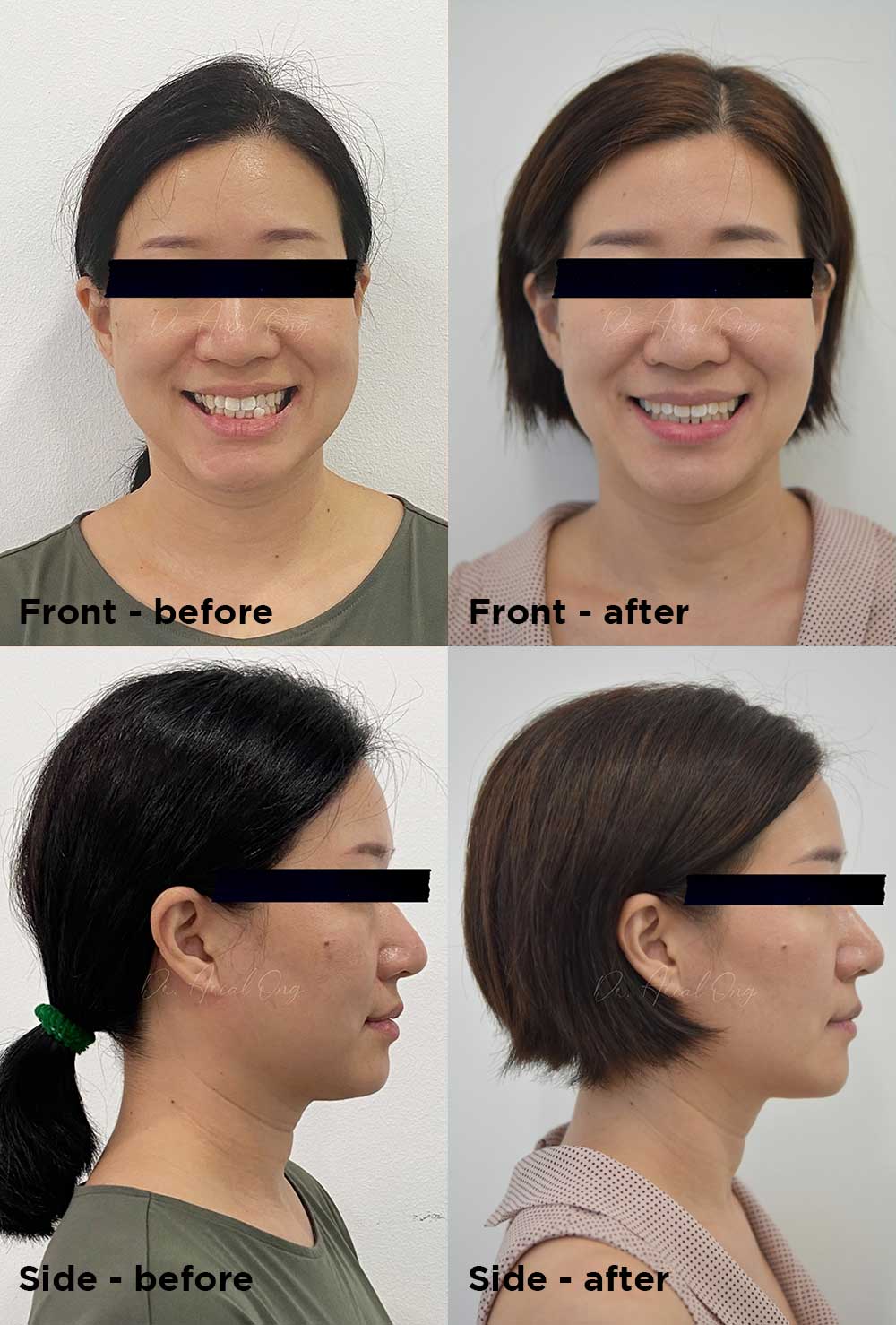 Teeth Assessment Before & After