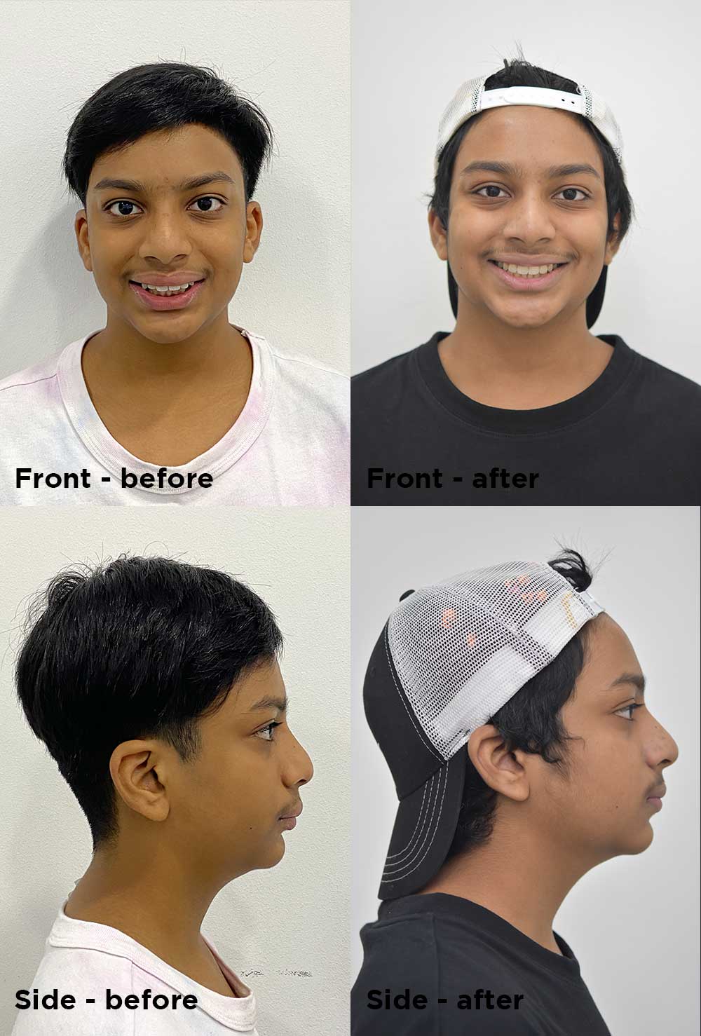 Before & After Patient Photos