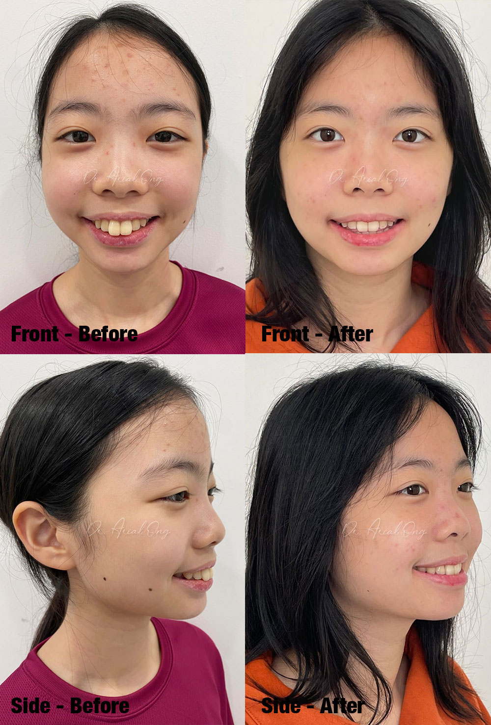 Before & After Teeth Assessment