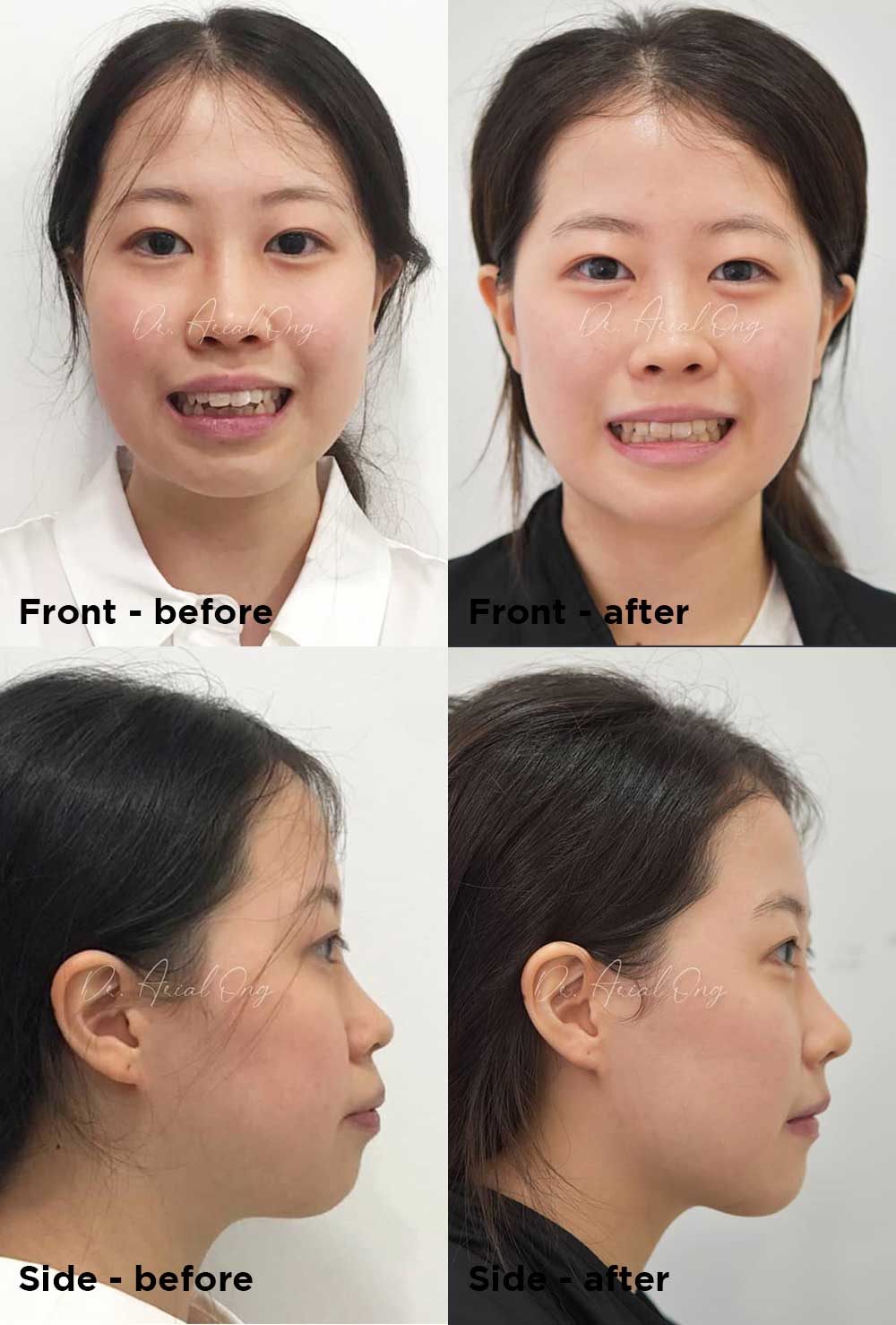 Before & After Smile Assessment