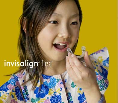 Invisalign Braces For Kids