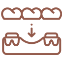 implant supported bridge