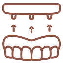 implant supported denture