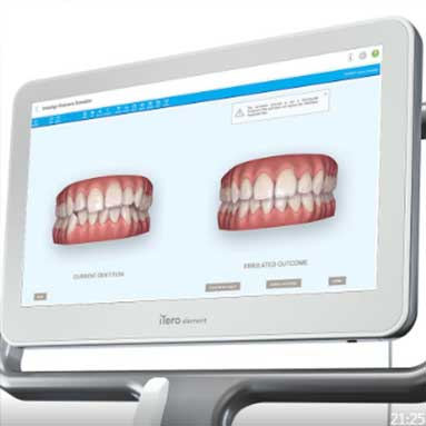 Personalised Outcome Simulation